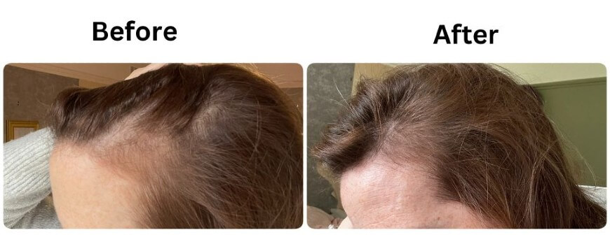 vegamour gro results