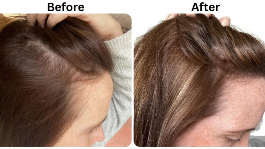 side view of hair before and after using vegamour gro hair serum
