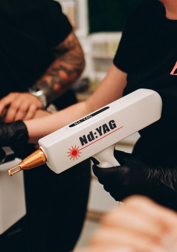 A person wearing black gloves holds an Nd:YAG laser device, likely for tattoo removal, while another person’s tattooed arm rests nearby.