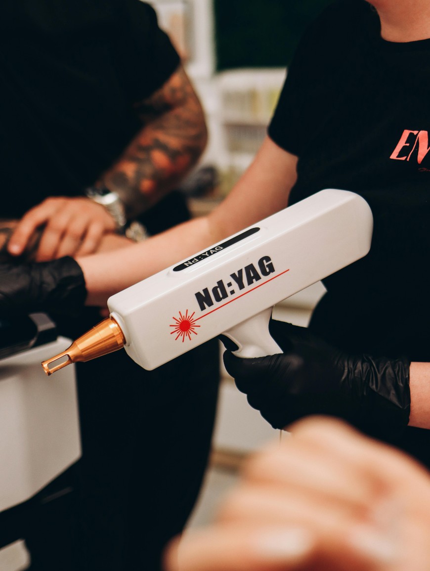 A person wearing black gloves holds an ND:YAG laser device, preparing for a treatment, while another person’s arm is visible nearby. The scene appears to be in a clinic or beauty salon.