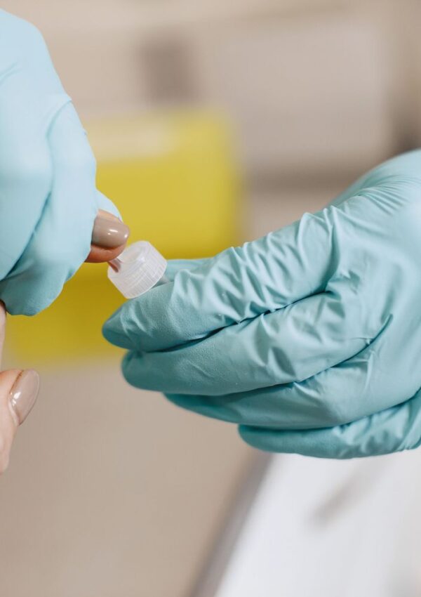 A person wearing blue gloves holds a dropper near someones hand, possibly preparing to collect a sample or apply a liquid for a medical or laboratory procedure.